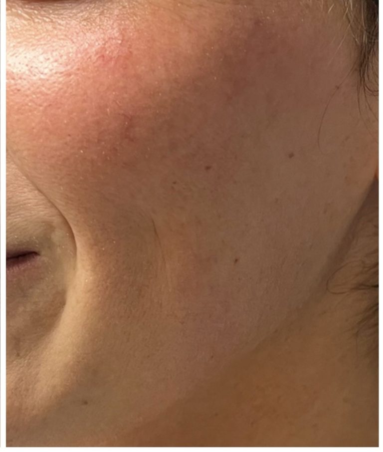 After Image