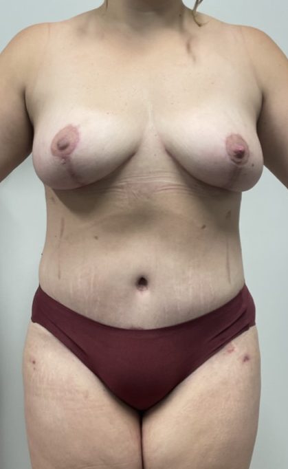 After Image
